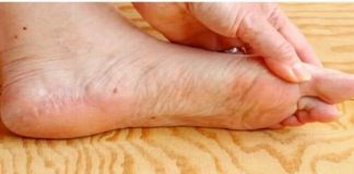 7 znakova da se tijelo već duže vrijeme bori s VISOKIM ŠEĆEROM UKRVI: Prvo ćete to primijetiti na očima i nogama! 7 znakova da se tijelo već duže vrijeme bori s VISOKIM ŠEĆEROM UKRVI: Prvo ćete to primijetiti na očima i nogama! - featured image