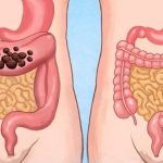 Popijte samo jednu čašu prije spavanja da biste očistili cijelo debelo crijevo za 10 minuta Popijte samo jednu čašu prije spavanja da biste očistili cijelo debelo crijevo za 10 minuta - featured image