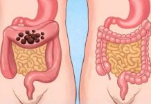 Popijte samo jednu čašu prije spavanja da biste očistili cijelo debelo crijevo za 10 minuta Popijte samo jednu čašu prije spavanja da biste očistili cijelo debelo crijevo za 10 minuta - featured image