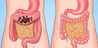 Popijte samo jednu čašu prije spavanja da biste očistili cijelo debelo crijevo za 10 minuta Popijte samo jednu čašu prije spavanja da biste očistili cijelo debelo crijevo za 10 minuta - featured image