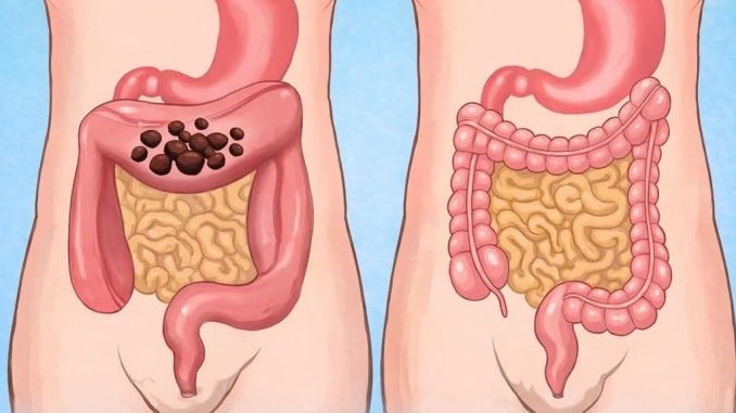 Popijte samo jednu čašu prije spavanja da biste očistili cijelo debelo crijevo za 10 minuta Popijte samo jednu čašu prije spavanja da biste očistili cijelo debelo crijevo za 10 minuta - featured image