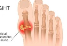 IZBACITE MOKRAĆNU KISELINU IZ TIJELA, IZBACITE GIHT: 3 narodna lijeka koja provjereno djeluju, OVO ĆE VAM POMOĆI! (RECEPT) IZBACITE MOKRAĆNU KISELINU IZ TIJELA, IZBACITE GIHT: 3 narodna lijeka koja provjereno djeluju, OVO ĆE VAM POMOĆI! (RECEPT) - featured image
