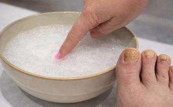 Samo 3 sastojka za žute i zadebljale nokte! GLJIVICE NA NOKTIMA KAO RUKOM ODNESENE… Samo 3 sastojka za žute i zadebljale nokte! GLJIVICE NA NOKTIMA KAO RUKOM ODNESENE… - featured image