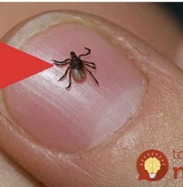 Spas od krpelja: Samo uradite ovo i NEĆE dirati ni vas ni vašeg psa + savjet kako da ih izbacite iz vašeg dvorišta! Spas od krpelja: Samo uradite ovo i NEĆE dirati ni vas ni vašeg psa + savjet kako da ih izbacite iz vašeg dvorišta! - featured image