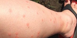 KOMARCI VAM PRAVE PAKAO OD ŽIVOTA? Samo isijecite OVO VOĆE na pola i ostavite u sobi, VIŠE IH NIKADA NEĆETE VIDJETI BLIZU! KOMARCI VAM PRAVE PAKAO OD ŽIVOTA? Samo isijecite OVO VOĆE na pola i ostavite u sobi, VIŠE IH NIKADA NEĆETE VIDJETI BLIZU! - featured image