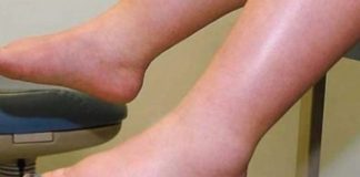 DA IZBACITE VIŠAK VODE POTREBAN VAM JE JEDAN VITAMIN: Ni noge vam više neće oticati, samo ga ubacite u ishranu DA IZBACITE VIŠAK VODE POTREBAN VAM JE JEDAN VITAMIN: Ni noge vam više neće oticati, samo ga ubacite u ishranu - featured image