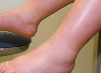DA IZBACITE VIŠAK VODE POTREBAN VAM JE JEDAN VITAMIN: Ni noge vam više neće oticati, samo ga ubacite u ishranu DA IZBACITE VIŠAK VODE POTREBAN VAM JE JEDAN VITAMIN: Ni noge vam više neće oticati, samo ga ubacite u ishranu - featured image