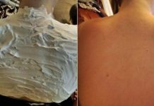 Izgorela je na suncu, a ovo ju je spasilo za 30 minuta: Svi to imamo u kući, a nije jogurt Izgorela je na suncu, a ovo ju je spasilo za 30 minuta: Svi to imamo u kući, a nije jogurt - featured image