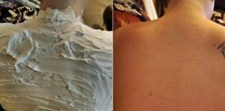 Izgorela je na suncu, a ovo ju je spasilo za 30 minuta: Svi to imamo u kući, a nije jogurt Izgorela je na suncu, a ovo ju je spasilo za 30 minuta: Svi to imamo u kući, a nije jogurt - featured image