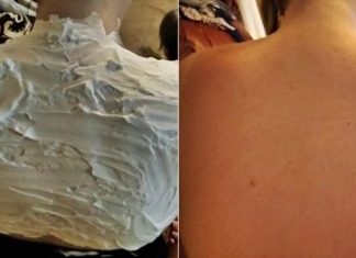 Izgorela je na suncu, a ovo ju je spasilo za 30 minuta: Svi to imamo u kući, a nije jogurt Izgorela je na suncu, a ovo ju je spasilo za 30 minuta: Svi to imamo u kući, a nije jogurt - featured image