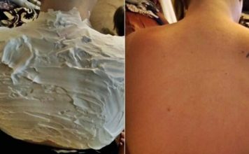 Izgorela je na suncu, a ovo ju je spasilo za 30 minuta: Svi to imamo u kući, a nije jogurt Izgorela je na suncu, a ovo ju je spasilo za 30 minuta: Svi to imamo u kući, a nije jogurt - featured image
