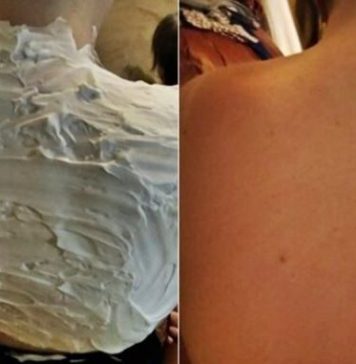 Izgorela je na suncu, a ovo ju je spasilo za 30 minuta: Svi to imamo u kući, a nije jogurt Izgorela je na suncu, a ovo ju je spasilo za 30 minuta: Svi to imamo u kući, a nije jogurt - featured image
